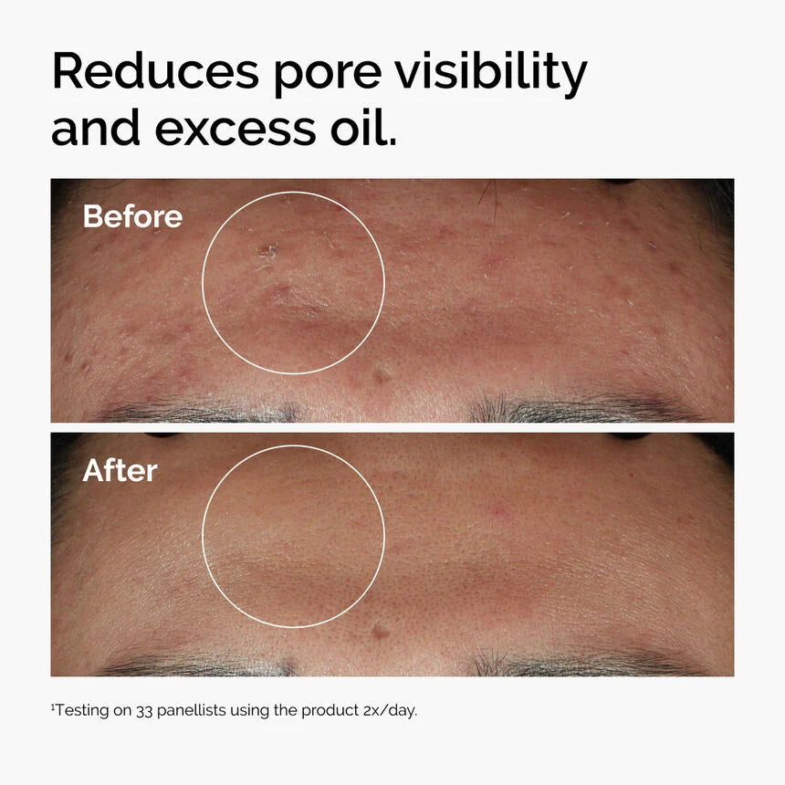 Suero Niacinamida 10% The Ordinary