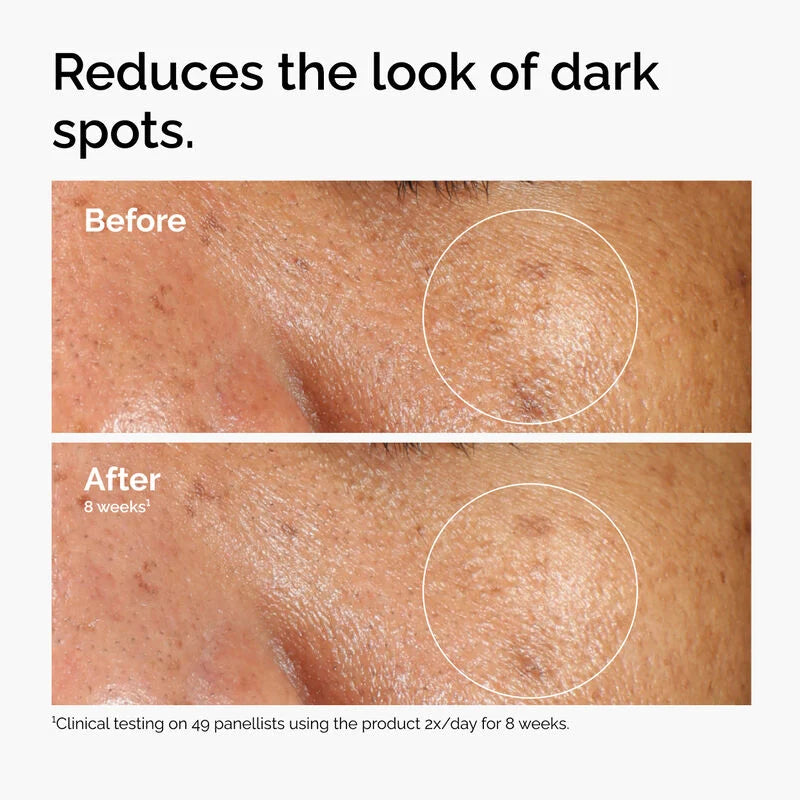 Alpha Arbutin 2% + HA The Ordinary