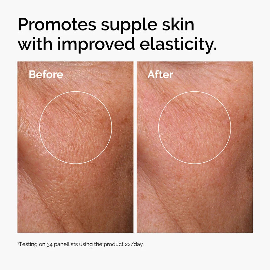 Suero Acido Hialuronico The Ordinary