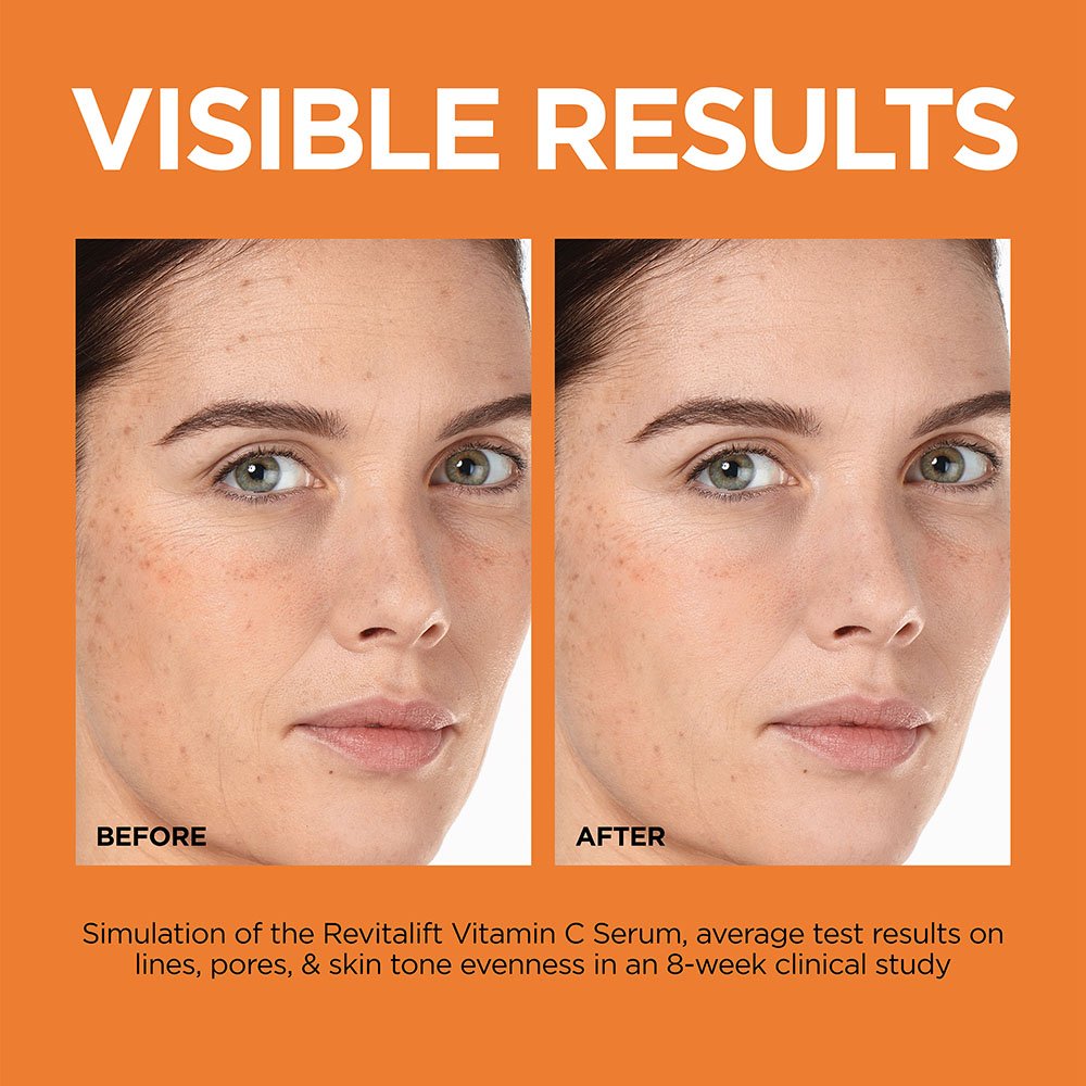 LOREAL REVITALIFT SUERO VITAMINA C 12%