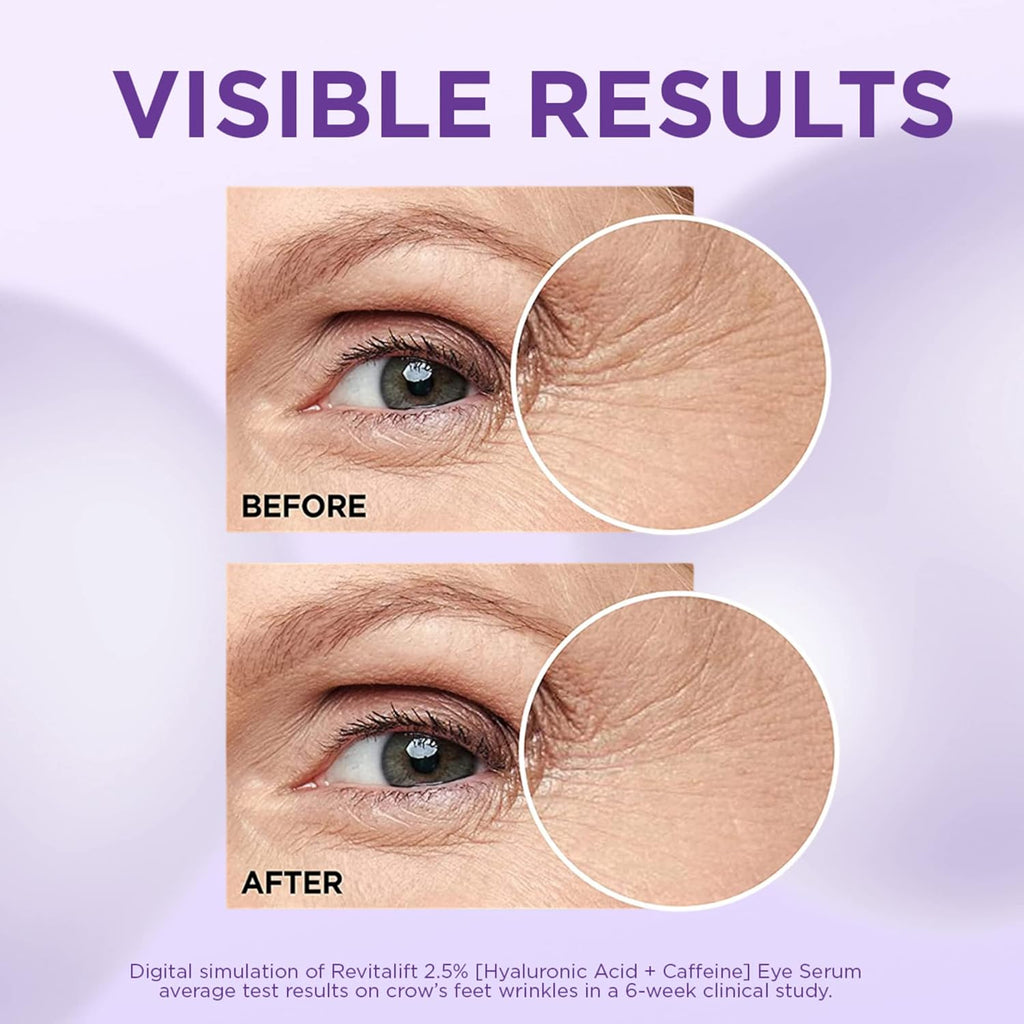 LOREAL REVITALIFT EYE SERUM 2.5% HYALURONIC ACID + CAFFEINE