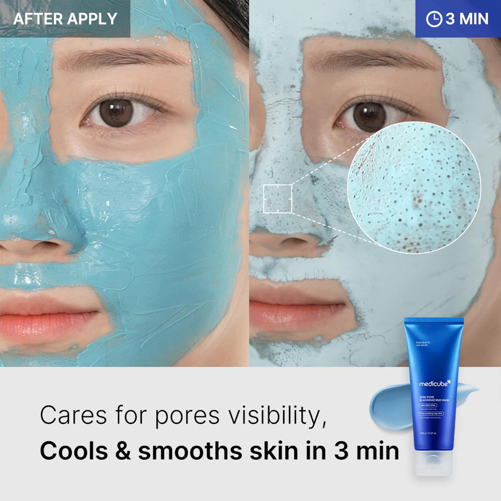 MEDICUBE ZERO PORE BLACKHEAD MUD MASK