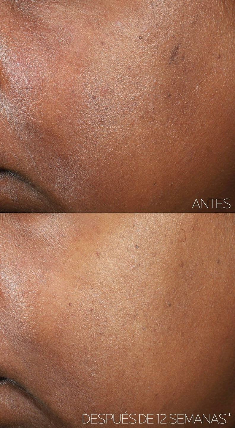 LA ROCHE POSAY MELA B3 SERUM