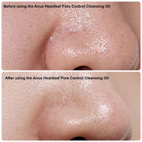 Aceite Limpiador Heartleaf Anua