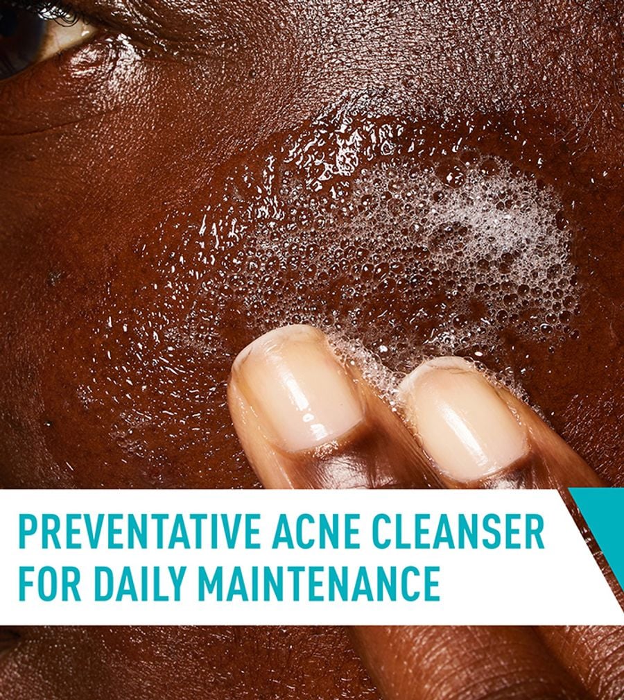 CERAVE ACNE CONTROL CLEANSER 8 OZ