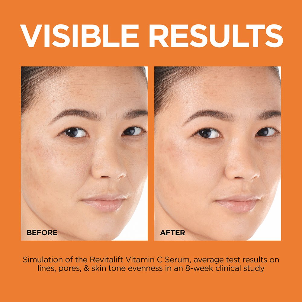 LOREAL REVITALIFT SUERO VITAMINA C 12%