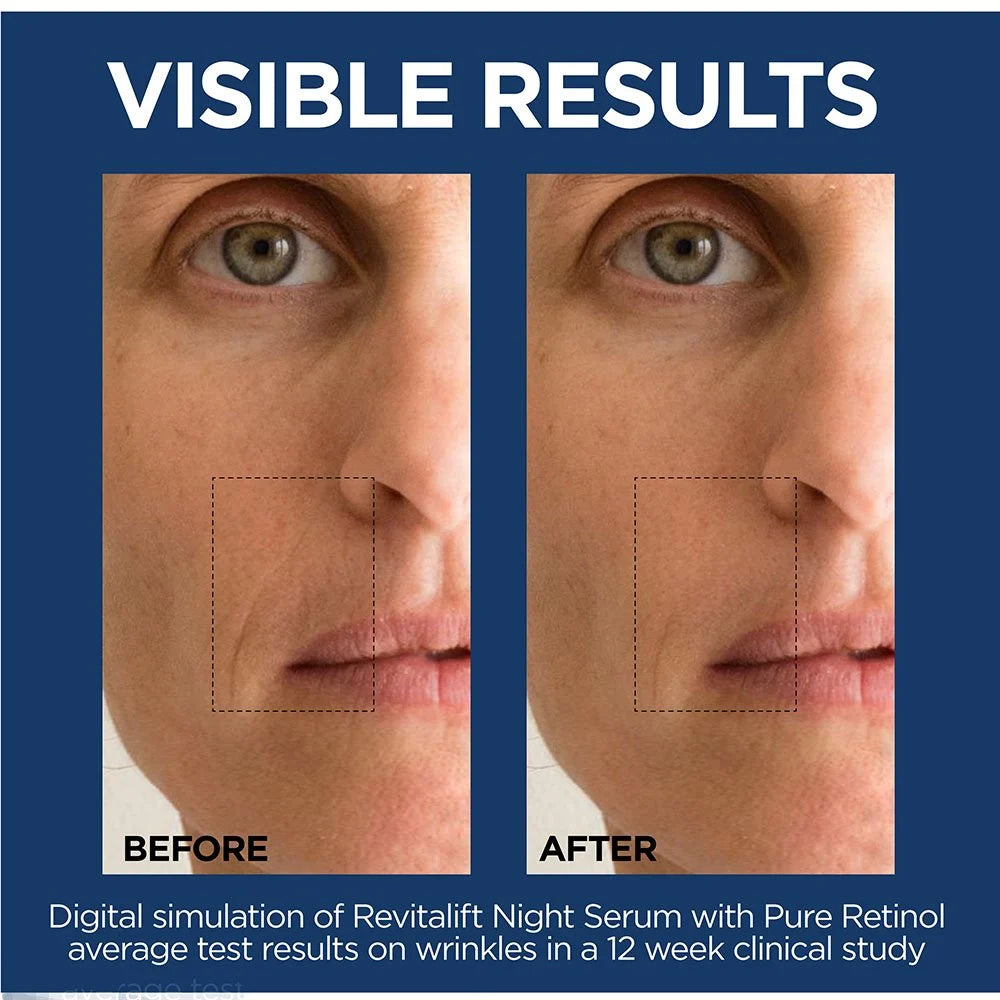 LOREAL REVITALIFT SUERO RETINOL PURO 0.3%