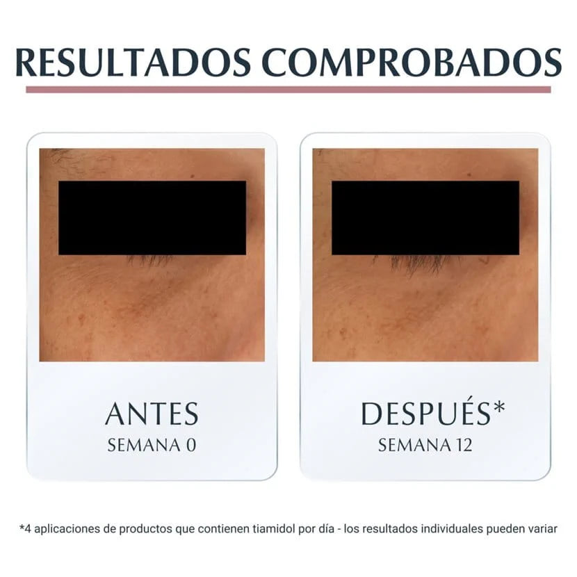 EUCERIN ANTI PIGMENT CORRECTOR DE OJERAS
