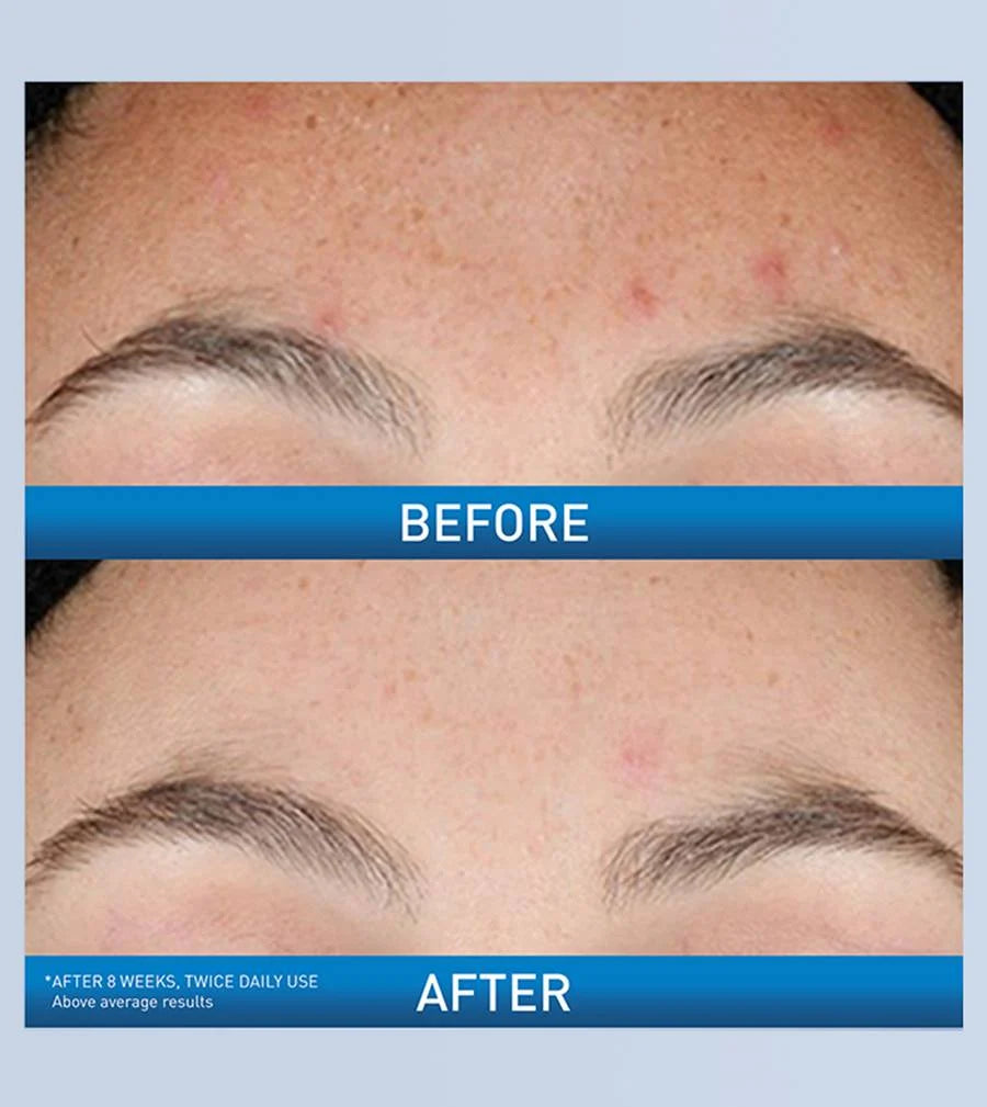 CERAVE RESURFACING RETINOL SERUM (Suero Marcas y manchas Post Acne)