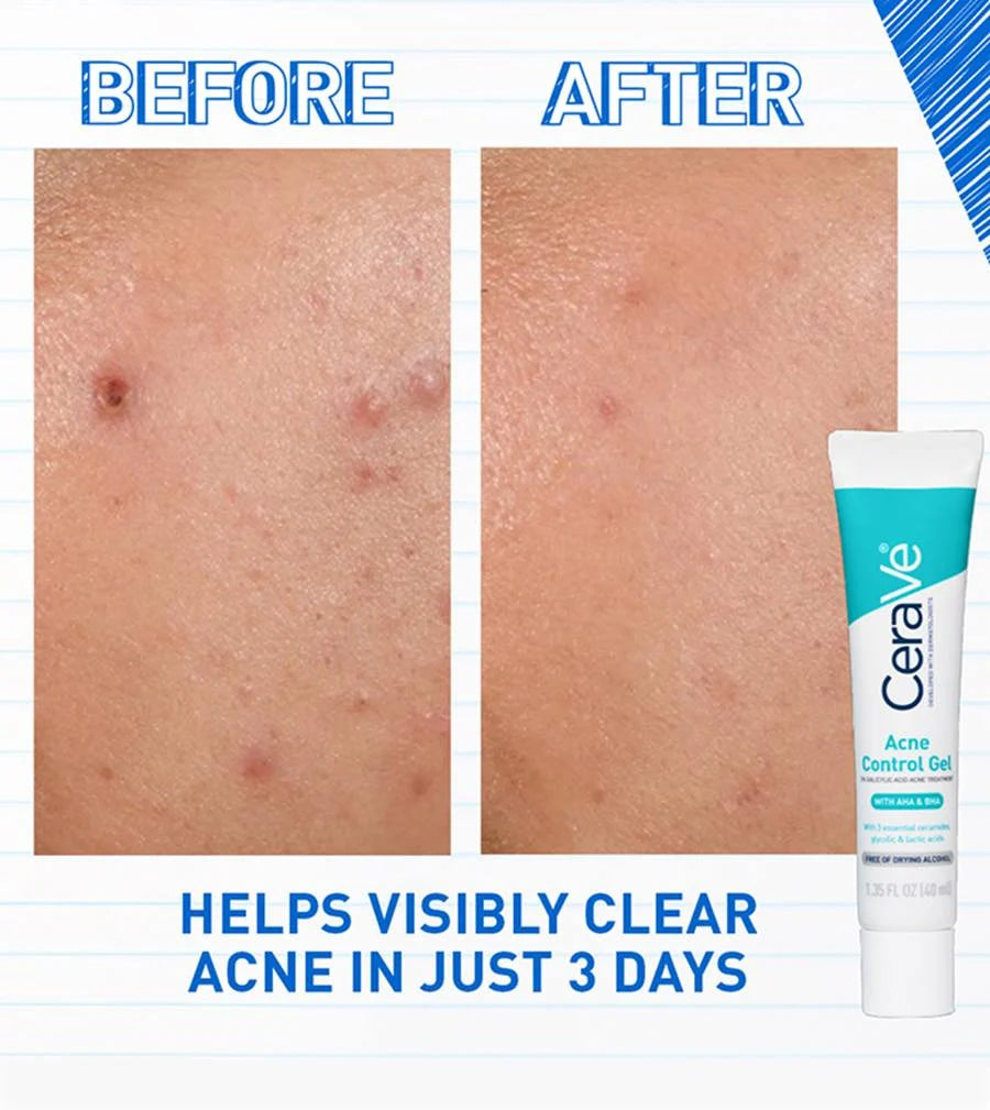 CERAVE ACNE CONTROL GEL (Tratamiento acne)