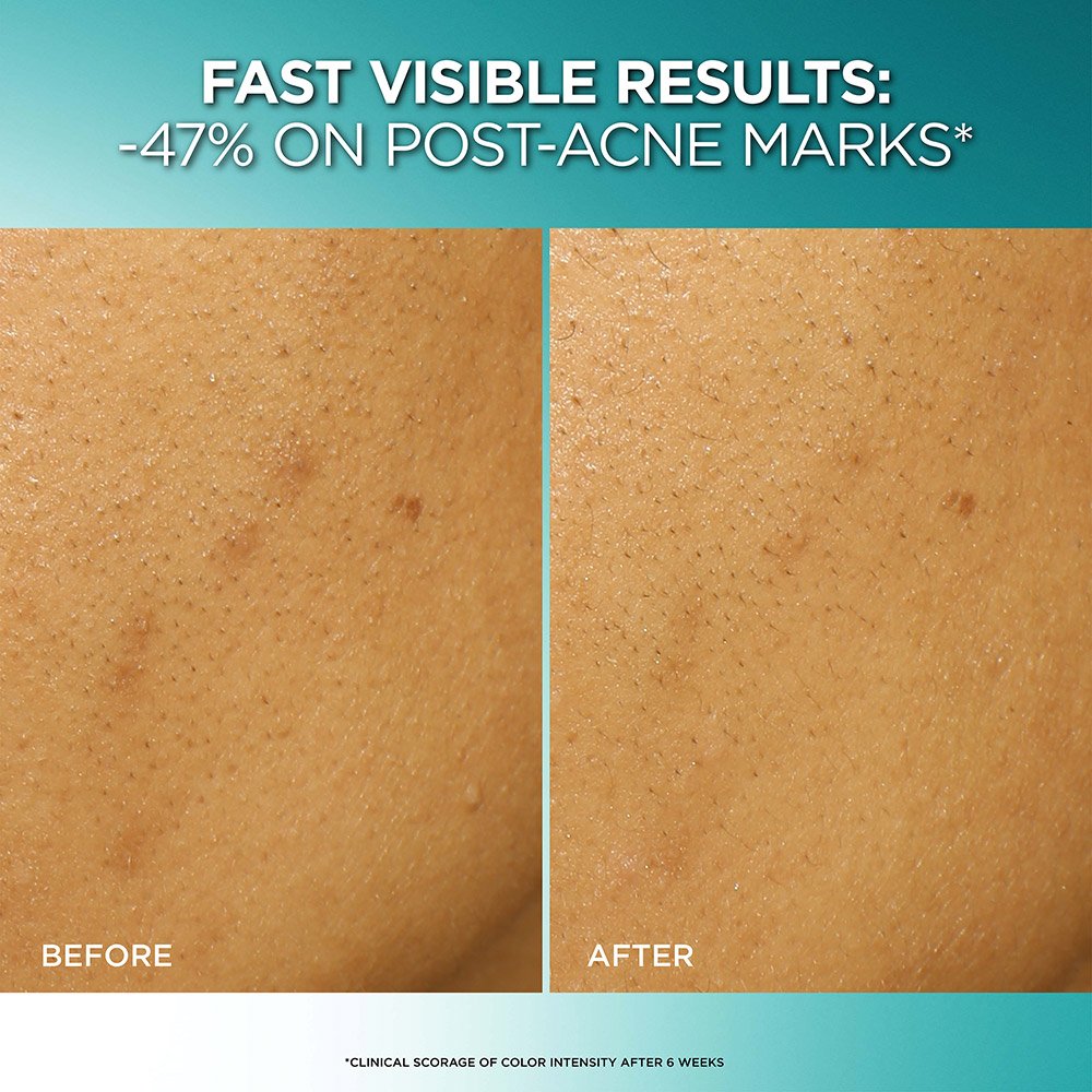 LOREAL BRIGHT REVEAL DARK SPOT EXFOLIANT PEEL