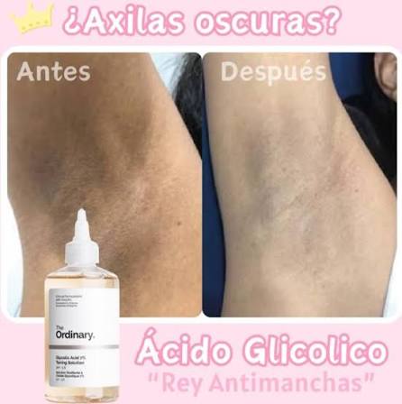 THE ORDINARY GLYCOLIC ACID EXFOLIATING TONER 240 ML